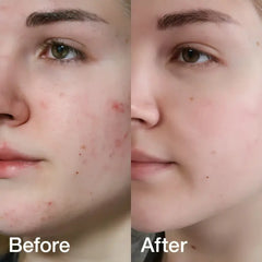 Medicube Red Line Full Set Medicube